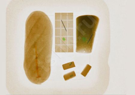 Рентгенотелевизионная установка Калан-2М