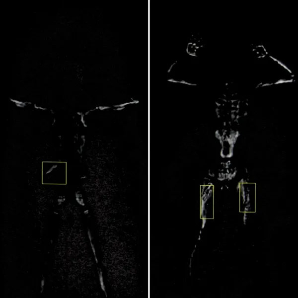 Досмотровый сканер Генезис МД-02А, мм-волновый