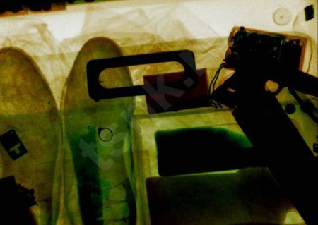 Рентгенотелевизионная установка Калан-2М